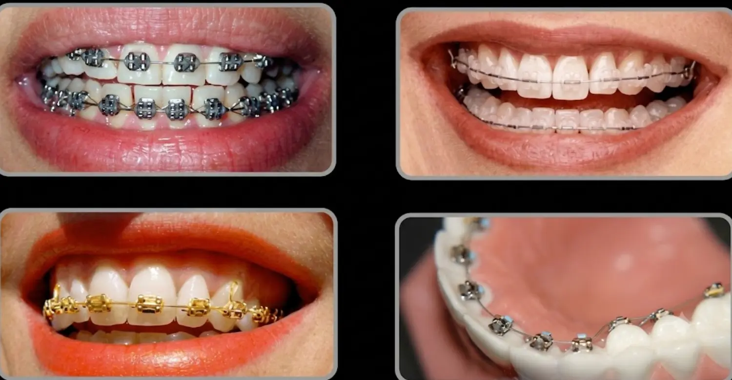 How Does Orthodontics Work 2